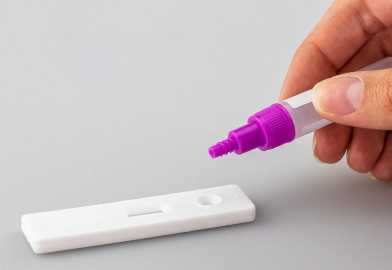 Les pharmacies de la Rive-Sud devraient recevoir des tests de dépistage rapide pour la COVID-19 d’ici le 11 janvier. Photo : Pixabay