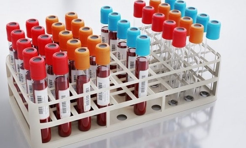 Héma-Québec veut du sang neuf