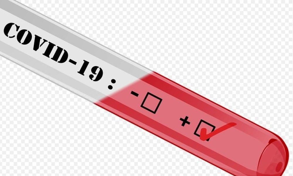 Le nombre de cas actifs de COVID-19 à la hausse en Montérégie